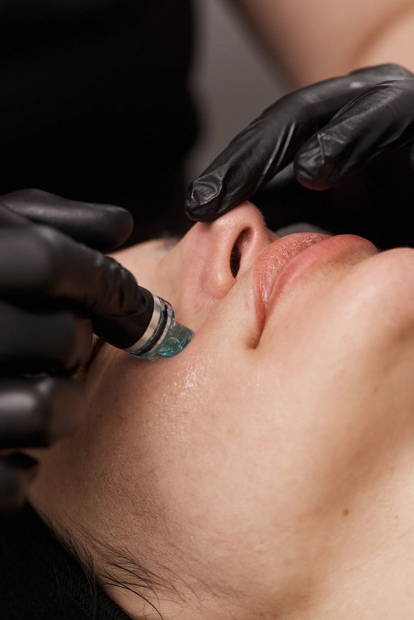 Hydrafacial
