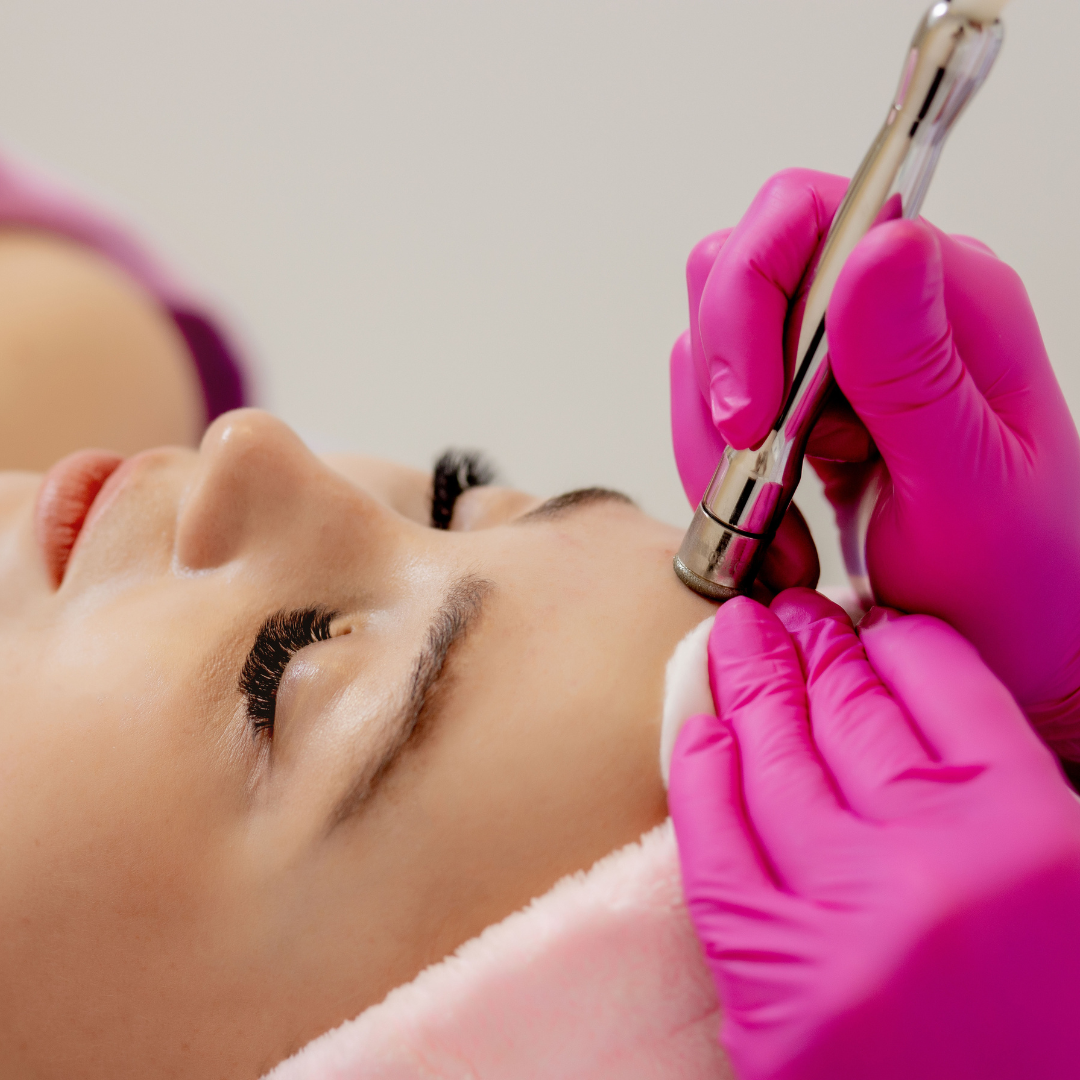Microdermabrasion
