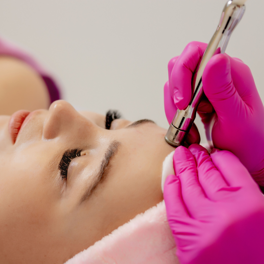 Microdermabrasion