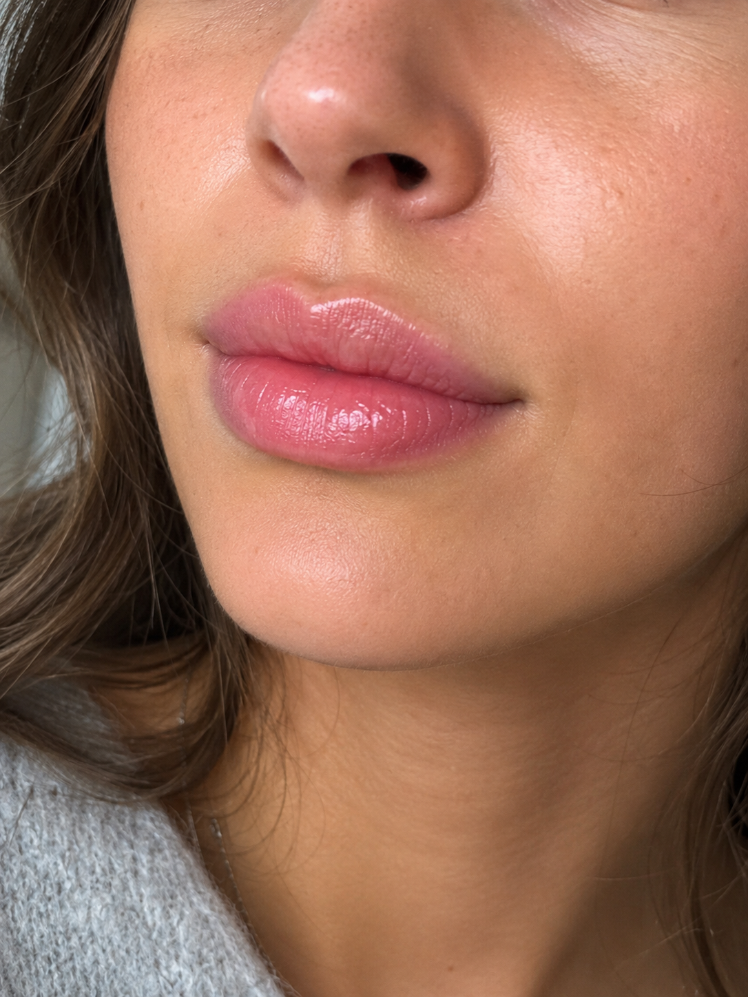 Bacio - Microneedling