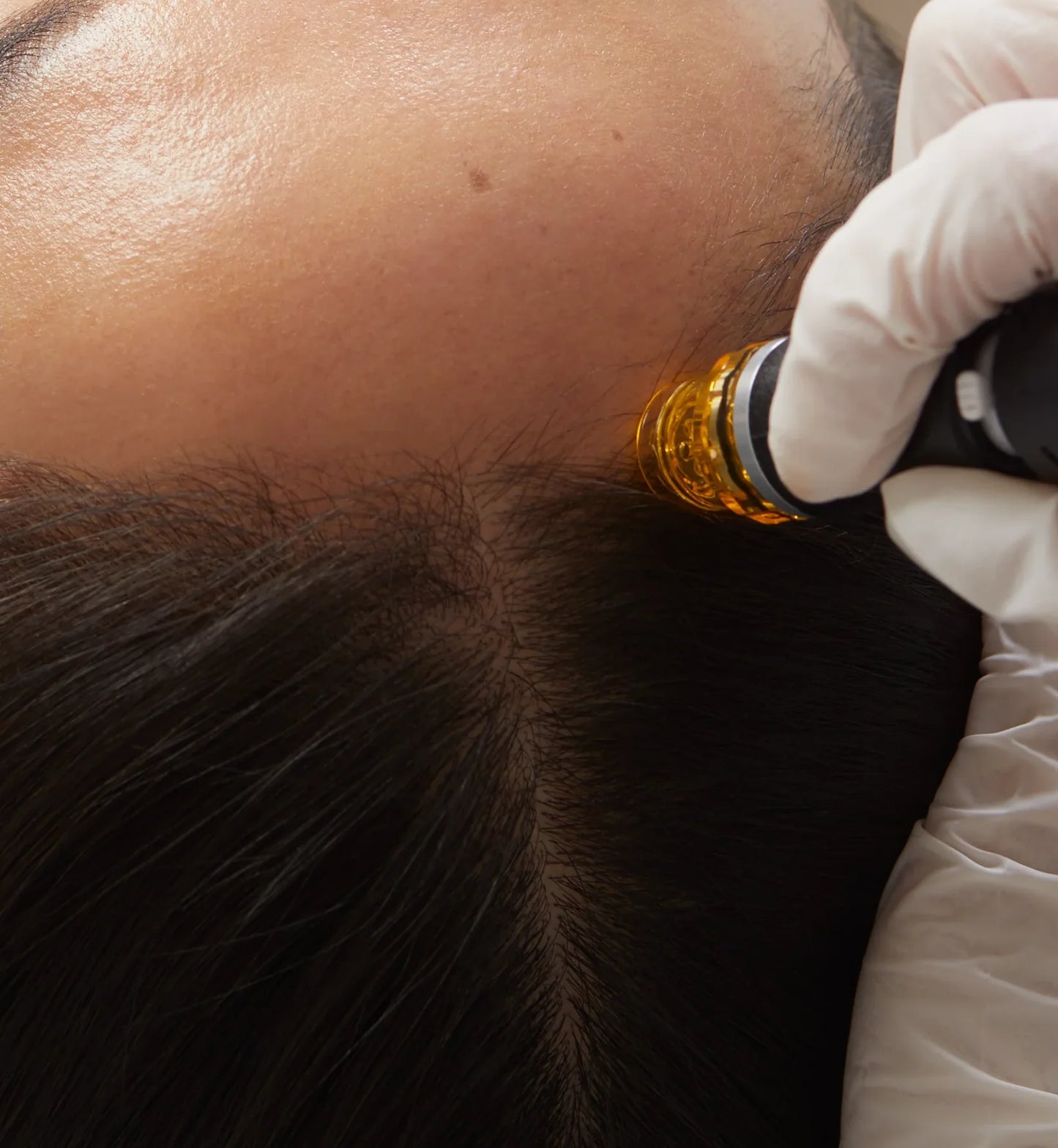 Hydrafacial